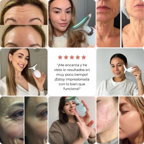 SkinLift™ - Rejuvenece tu piel desde casa